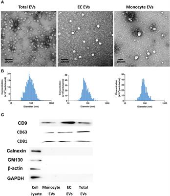 Circulating extracellular vesicles are associated with the clinical outcomes of sepsis